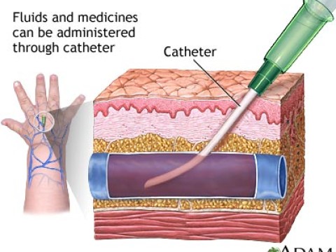 intravenously