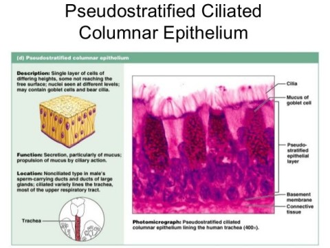 columnar