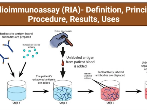 radioimmunoassay