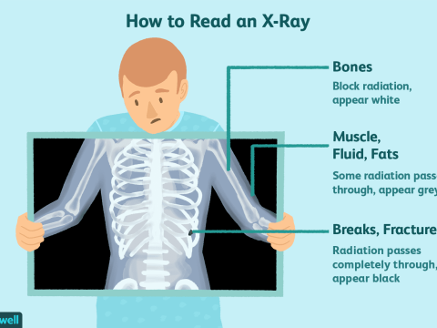 X-rays