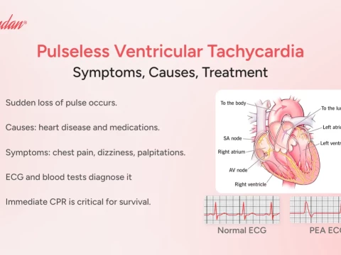 pulseless