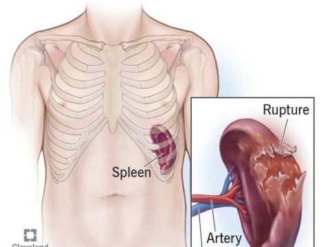 splenic