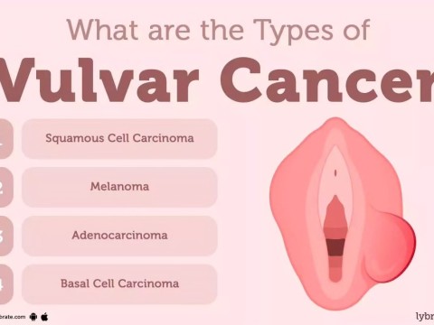 vulvar