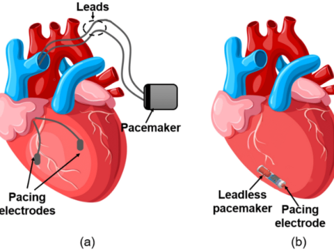 leadless