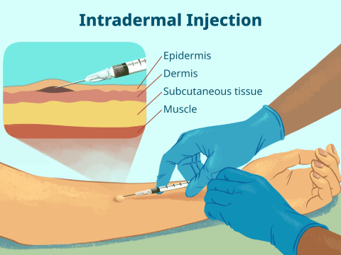 inject