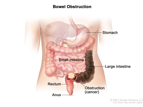 bowel